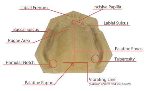 Full Arch Impressions Wiand Dental Lab