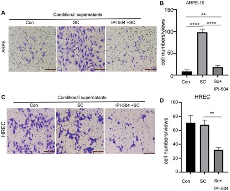 Ipi 504 Inhibit Senescent Arpe 19 Cells Mediated Cell Migration A Download Scientific