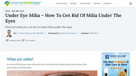 how to get rid of milia under eyes – Beauty Tips