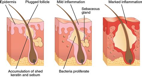 Diseases Disorders And Injuries Anatomy And Physiology I