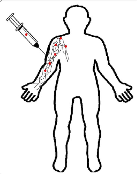 Systemic Delivery Of Nanoparticles By Intravenous Injection