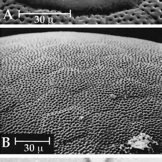 Scanning Electron Micrographs And Photomicro Graph Of Eggs Of L