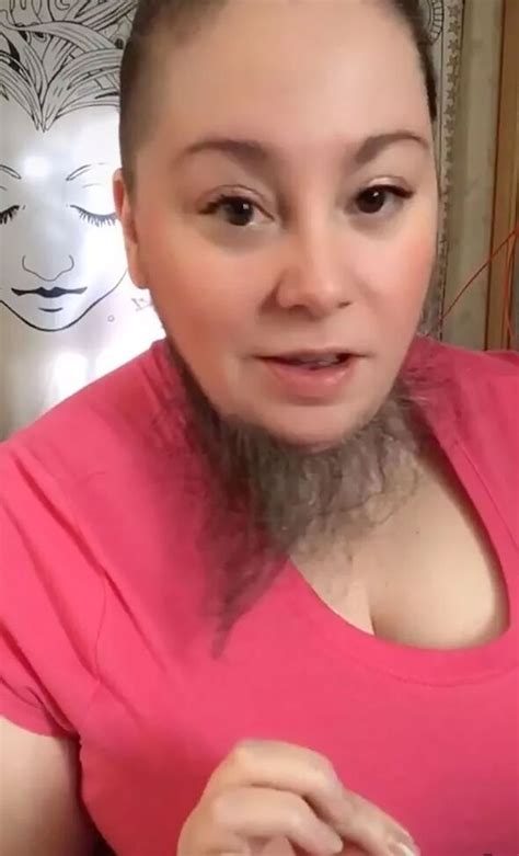 Woman Tired Of Shaving Embraces Full Beard And Straightens It To Make