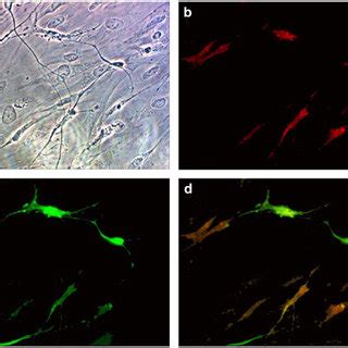 Primary Tissue Culture Of Glioblastoma A Phase Contrast Microscopic