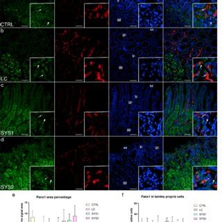 Co Expression Of Panx And Sma In The Gastric Mucosa Of Patients With