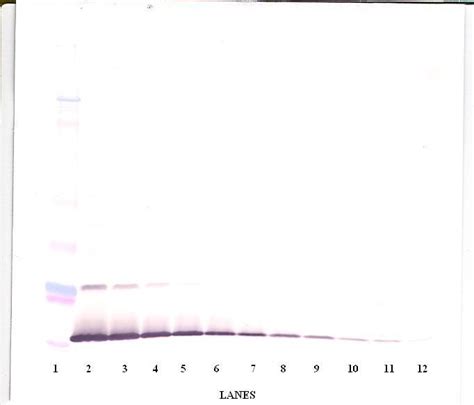 IL-13 Antibody - Cat. No. XP-5167 | ProSci