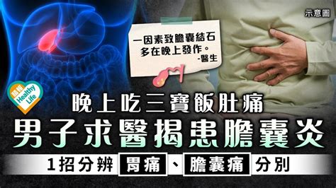 上腹痛｜晚上吃三寶飯肚痛 男子求醫揭患膽囊炎 1招分辨胃痛、膽囊痛分別 晴報 健康 其他疾病 D240106