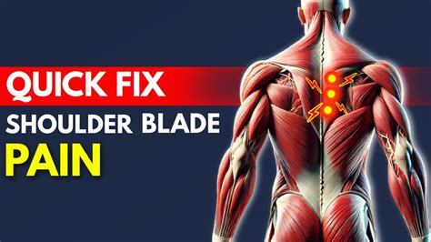 How To Fix Shoulder Blade Pain Quickly Rhomboid Pain YouTube