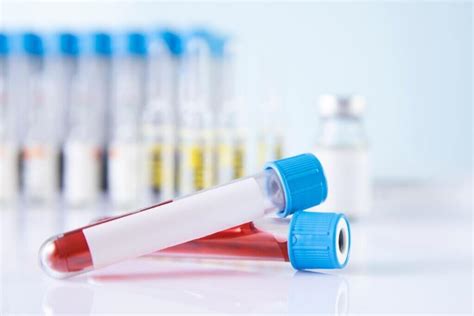 The 7 Most Essential Blood Tests Bodyvie