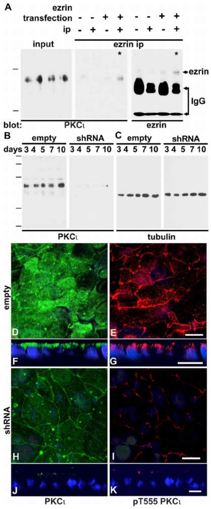 Pkc Interacts With Ezrin In Vivo Knockdown Of Pkc With Shrna