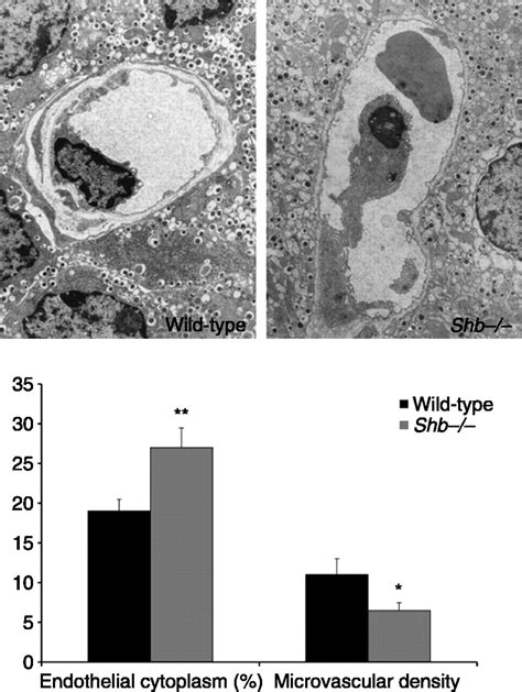 Impaired Glucose Homeostasis In Shb−− Mice In Journal Of