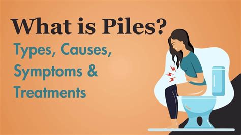 piles types  symptoms  treatments