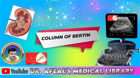Column Of Bertin On Ultrasound What It Is And What It Means