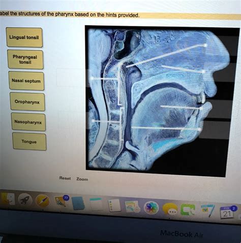 SOLVED Abel The Structures Of The Pharynx Based On The Hints Provided