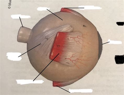 Eyesuperior View Diagram Quizlet