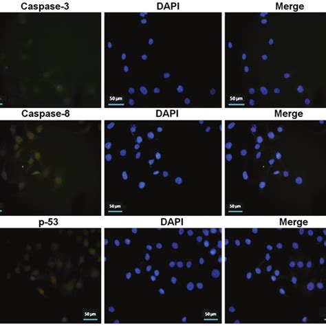 Cd133 High Cd44 High Prostate Cancer Stem Cells Isolated With The