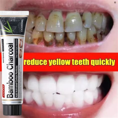 Sadoer Whitening Toothpaste Pasta Gigi Pemutih Gigi Pasta Gigi Bambu