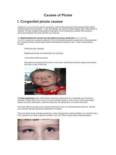 Causes of Ptosis | PDF | Diseases And Disorders | Clinical Medicine