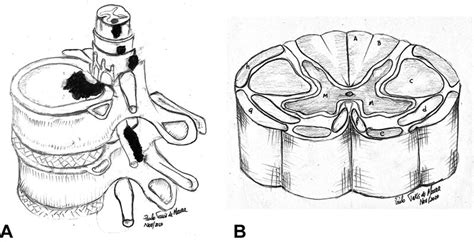 illustrates the cross section of the spinal cord and the... | Download ...