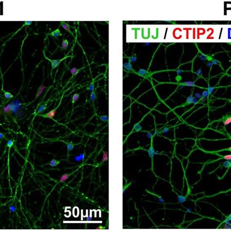 Characterisation Of Ipsc Derived Cortical Neurons Patient Derived