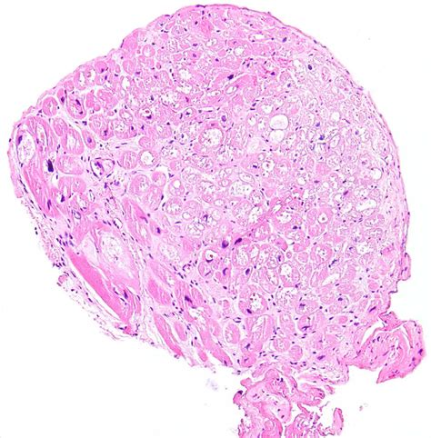 Light microscopy (Hematoxylin and eosin stain with magnification Â40)... | Download Scientific ...