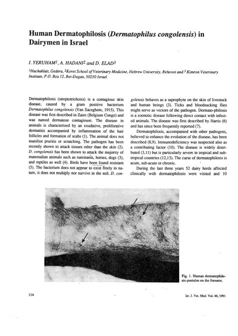 Pdf Human Dermatophilosis Dermatophilus Congolensis In Dairymen In