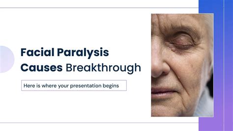 Facial Paralysis Causes Breakthrough Presentation