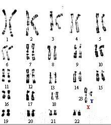 Cas Donn Es Ph Notypiques Et Caryotype Site Des Ressources D