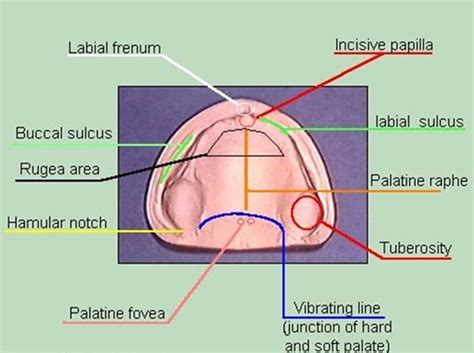 Posterior Palatal Seal Fovea Palatini