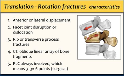 The Radiology Assistant Tlics Classification Of Fractures