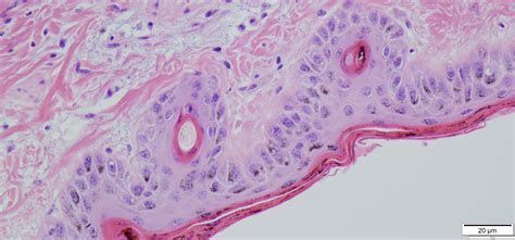 histology department  pathology vrogueco
