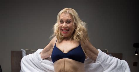 Shameless Star Tina Malone Shows Off The Skin She Had Removed In