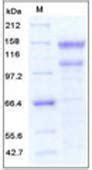 Human Recombinant LDLR LDL Receptor Protein His Tag From HEK293