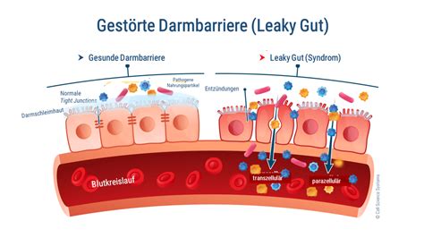 Das Leaky Gut Syndrom einfach erklärt Ursachen und Therapie