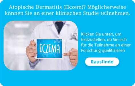 Eczema & Stress | Stress Eczema Treatment | Eczema Due To Stress | Eczema Less