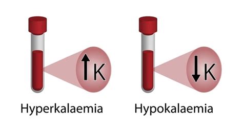 260 Blood Potassium Levels Royalty-Free Images, Stock Photos & Pictures ...