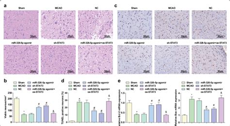 Up Regulation Of Mir P Or Down Regulation Of Stat Impedes