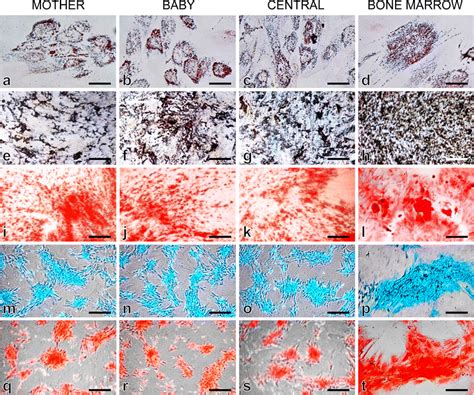 Determination Of Trilineage Differentiation Potential Of Mbc Wjmscs And Download Scientific