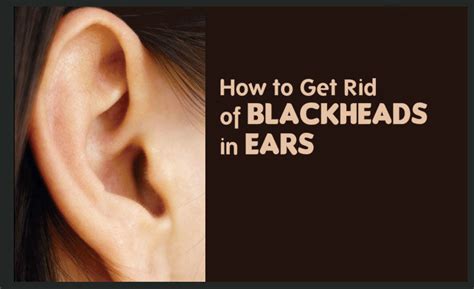 How to Get Rid of Blackheads in Ear