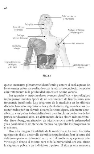 Sida Lo Que Todos Debemos Saber Para Prevenir Trillas En Venta En