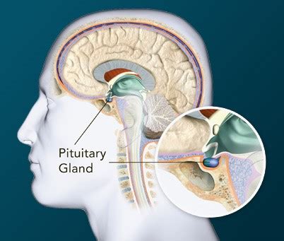 Pituitary Tumor Surgery | Best Brain Surgeon in Pune