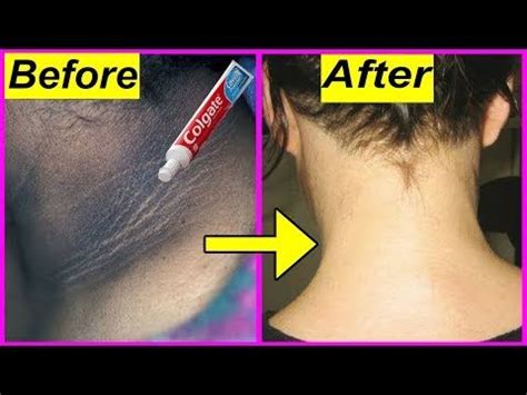 Just Minutes Whitening Challenge Permanently How To Get Rid Of Dark