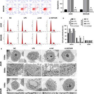 HOTAIR Regulated The Cell Cycle Apoptosis And Autophagy Of A549 And