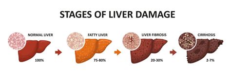 Signs Your Liver Is Healing From Alcohol Garden State Detox