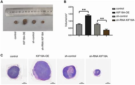 Kif18a Improves Migration And Invasion Of Colorectal Cancer Crc Cells