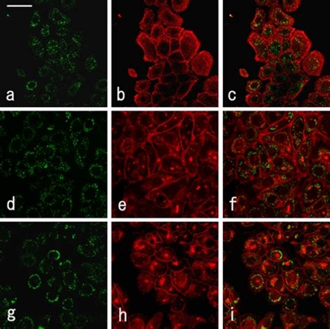 Localization Of Man II And ALP In McA RH 7777 Cells Incubated In Basal