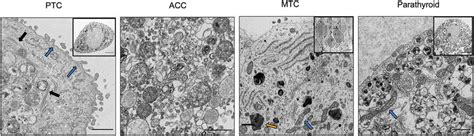 Morphologic Features Of D Endocrine Pdos On Transmission Electron