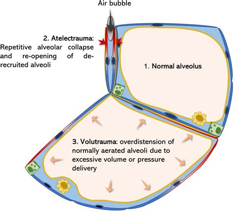 Frontiers Alveolar Dynamics And Beyond The Importance Of Surfactant