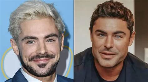 Zac Efron Explains What Happened To His Face Following Plastic Surgery