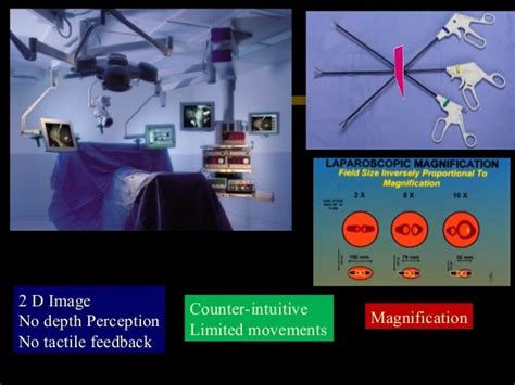 Ergonomics For Laparoscopic Surgeon